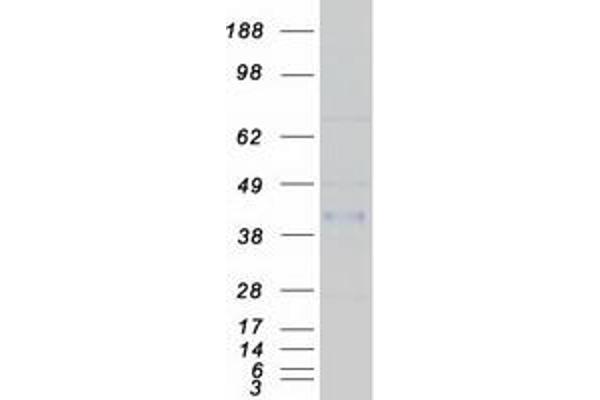 CRELD1 Protein (Transcript Variant 1) (Myc-DYKDDDDK Tag)