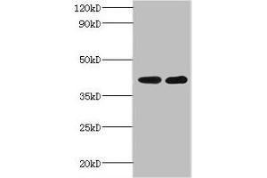 Western blot All lanes: GLT8D2 antibody at 2 μg/mL Lane 1: Mouse heart tissue Lane 2: Mouse kidney tissue Secondary Goat polyclonal to rabbit IgG at 1/10000 dilution Predicted band size: 41 kDa Observed band size: 41 kDa (GLT8D2 Antikörper  (AA 25-349))