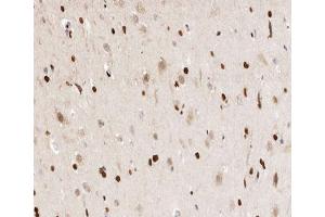 ABIN6266456 at 1/200 staining human brain tissue sections by IHC-P.