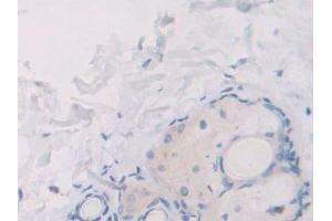 Immunohistochemistry (IHC) image for anti-Uncoupling Protein 1 (Mitochondrial, Proton Carrier) (UCP1) (AA 179-296) antibody (ABIN7436078)