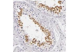 Immunohistochemical staining of human testis with FAM181A polyclonal antibody  shows distinct cytoplasmic positivity in cells in seminiferus ducts. (FAM181A Antikörper)