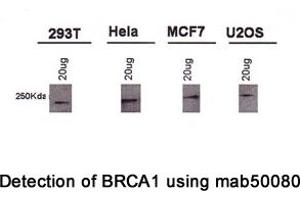 Image no. 4 for anti-Breast Cancer 1 (BRCA1) (AA 1314-1600), (AA 1314-1864) antibody (ABIN363234) (BRCA1 Antikörper  (AA 1314-1600, AA 1314-1864))