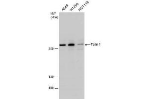 WB Image Talin 1 antibody detects Talin 1 protein by western blot analysis. (TLN1 Antikörper  (C-Term))