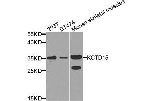 Western blot analysis of extracts of various cell lines, using KCTD15 antibody. (KCTD15 Antikörper)