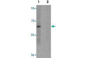 Western blot analysis of mouse lung tissue with ZSCAN4 polyclonal antibody  in (Lane 1) the absence and (Lane 2) presence of peptide blocking. (ZSCAN4 Antikörper  (C-Term))