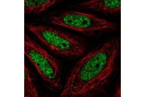 Immunofluorescent staining of SiHa cells with NR4A2 polyclonal antibody  (Green) shows positivity in nucleus but excluded from the nucleoli. (NR4A2 Antikörper)