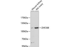 Western blot analysis of extracts of various cell lines, using ZNF268 antibody (ABIN6133062, ABIN6150485, ABIN6150486 and ABIN6216704) at 1:3000 dilution. (ZNF268 Antikörper  (AA 1-270))