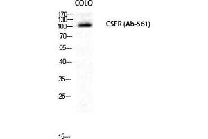 Western Blot (WB) analysis of COLO205 cells using c-Fms Polyclonal Antibody.