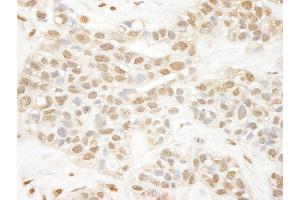 Immunohistochemistry (IHC) image for anti-Proprotein Convertase Subtilisin/kexin Type 2 (PCSK2) (AA 150-200) antibody (ABIN7448718)
