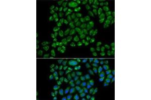 Immunofluorescence analysis of HeLa cells using GRIA3 Polyclonal Antibody (Glutamate Receptor 3 Antikörper)