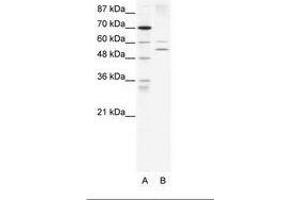 Image no. 1 for anti-Autoimmune Regulator (AIRE) (AA 76-125) antibody (ABIN203264) (AIRE Antikörper  (AA 76-125))