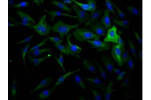 Immunofluorescence staining of Hela Cells with ABIN7127459 at 1:50, counter-stained with DAPI. (Rekombinanter DNM2 Antikörper)