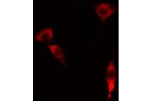 ABIN6274329 staining RAW264. (FOXC1 Antikörper)