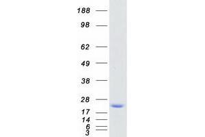 Western Blotting (WB) image for Myosin, Light Chain 2, Regulatory, Cardiac, Slow (MYL2) protein (Myc-DYKDDDDK Tag) (ABIN2726709)