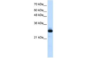 WB Suggested Anti-SAP30 Antibody Titration:  1. (SAP30 Antikörper  (Middle Region))