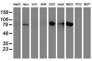 Image no. 2 for anti-Diacylglycerol Kinase, alpha 80kDa (DGKA) antibody (ABIN1497818) (DGKA Antikörper)