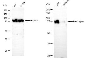 Western blotting analysis using PKC alpha antibody (ABIN7799991).