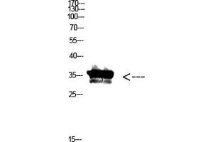 anti-Pan Myristoylation antibody