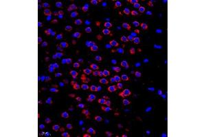 Immunofluorescent analysis of paraffin embedded mouse brain using Neurotensin (ABIN7074827) at dilution of 1: 500 (Neurotensin Antikörper)