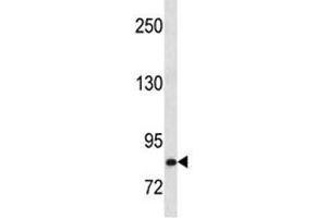 Western Blotting (WB) image for anti-Hepatocyte Growth Factor (Hepapoietin A, Scatter Factor) (HGF) (AA 521-554) antibody (ABIN3031185)