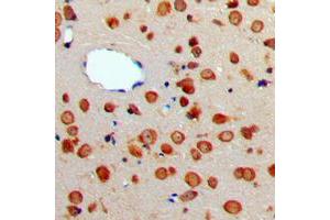 Immunohistochemistry (IHC) image for anti-Tumor Necrosis Factor (Ligand) Superfamily, Member 13 (TNFSF13) (Center) antibody (ABIN7297452)