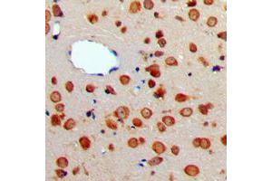 Immunohistochemical analysis of CD256 staining in human brain formalin fixed paraffin embedded tissue section. (TNFSF13 Antikörper  (Center))