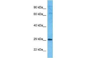 Host:  Rabbit  Target Name:  EXOS5  Sample Type:  721_B Whole Cell lysates  Antibody Dilution:  1. (EXOSC5 Antikörper  (N-Term))