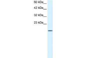 WB Suggested Anti-ZNF7 Antibody Titration:  1. (ZNF7 Antikörper  (N-Term))