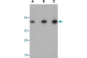 Western blot analysis of SCO2 in human liver tissue lysate with SCO2 polyclonal antibody  at (A) 0. (SCO2 Antikörper  (C-Term))