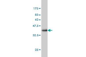 Western Blot detection against Immunogen (37. (SRF Antikörper  (AA 406-508))