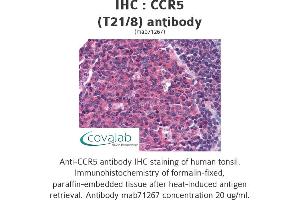 Image no. 1 for anti-Chemokine (C-C Motif) Receptor 5 (CCR5) antibody (ABIN1724086) (CCR5 Antikörper)