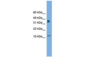 Image no. 1 for anti-Chromosome 15 Open Reading Frame 40 (C15orf40) (C-Term) antibody (ABIN6744994)