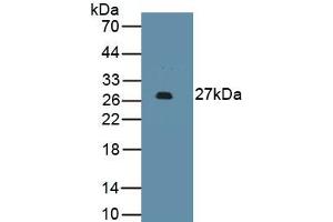 Detection of Recombinant PDCD1LG2, Human using Monoclonal Antibody to Programmed Cell Death Protein 1 Ligand 2 (PDL2) (PDCD1LG2 Antikörper  (AA 33-236))