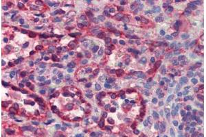 Human Spleen (formalin-fixed, paraffin-embedded) stained with CYCS antibody ABIN462359 followed by biotinylated anti-mouse IgG secondary antibody ABIN481714, alkaline phosphatase-streptavidin and chromogen.