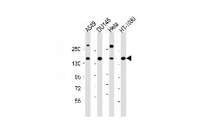 All lanes : Anti-COL4A1 Antibody (N-term) at 1:1000 dilution Lane 1: A549 whole cell lysate Lane 2: D whole cell lysate Lane 3: Hela whole cell lysate Lane 4: HT-1080 whole cell lysate Lysates/proteins at 20 μg per lane. (COL4A1 Antikörper  (N-Term))