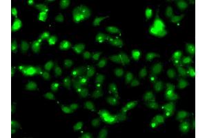 Immunofluorescence analysis of HeLa cell using CLK1 antibody. (CLK1 Antikörper)