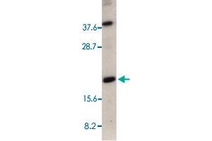 Western blot analysis of 50 ug of total cell lysate from HeLa cells with CRADD polyclonal antibody  at 1 : 500 dilution. (CRADD Antikörper  (AA 181-199))