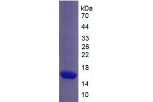 SDS-PAGE analysis of Monkey Collagen Type X Protein.
