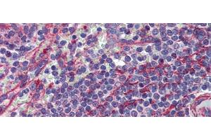 Rabbit Anti-MCTP1 Antibody  arp44441 Paraffin Embedded Tissue: Human Spleen Antibody Concentration: 5 ug/ml (MCTP1 Antikörper  (Middle Region))