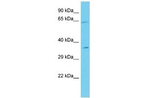 Host: Rabbit Target Name: ANKRD55 Sample Type: Jurkat Whole Cell lysates Antibody Dilution: 1. (ANKRD55 Antikörper  (C-Term))