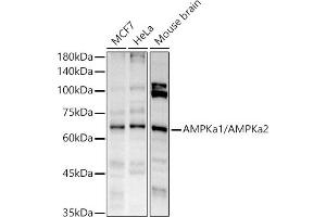 Western blot analysis of extracts of various cell lines, using AMPKa1/AMPKa2 antibody (ABIN6129902, ABIN6136848, ABIN6136849 and ABIN7101410) at 1:1000 dilution. (AMPK alpha Antikörper)