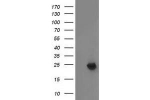 Western Blotting (WB) image for anti-Methylmalonic Aciduria (Cobalamin Deficiency) CblB Type (MMAB) antibody (ABIN1499509) (MMAB Antikörper)