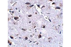 Immunohistochemical staining of mouse brain tissue with 2. (RCAN2 Antikörper  (Internal Region))