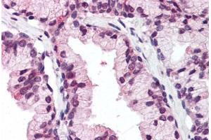 Human Prostate (formalin-fixed, paraffin-embedded) stained with DDX3X antibody ABIN337076 at 5 ug/ml followed by biotinylated goat anti-rabbit IgG secondary antibody ABIN481713, alkaline phosphatase-streptavidin and chromogen. (DDX3X Antikörper  (N-Term))