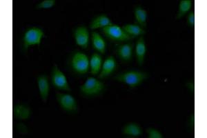Immunofluorescence staining of A549 cells with ABIN7144872 at 1:166, counter-stained with DAPI. (ABCA12 Antikörper  (AA 45-158))