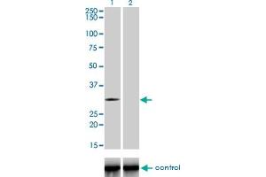 Western blot analysis of TLX3 over-expressed 293 cell line, cotransfected with TLX3 Validated Chimera RNAi (Lane 2) or non-transfected control (Lane 1).