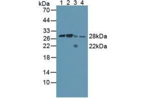 Figure. (Calpain S1 Antikörper  (AA 1-268))