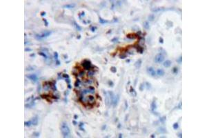 Used in DAB staining on fromalin fixed paraffin-embedded pancreas tissue