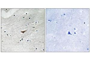 Immunohistochemistry analysis of paraffin-embedded human brain tissue using VE-Cadherin (Phospho-Tyr731) antibody. (Cadherin 5 Antikörper  (pTyr731))
