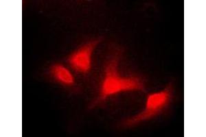 Immunofluorescent analysis of ABL1 staining in K562 cells. (ABL1 Antikörper  (C-Term))